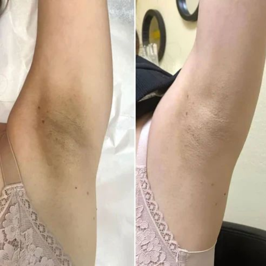 Dr. Melaxin Dúo Sérum Exfoliantes – Renovación Celular y Piel muerta