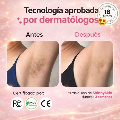 ShinnySkin® Depiladora Láser Permanente IPL