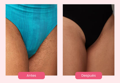 ShinnySkin® Depiladora Láser Permanente IPL